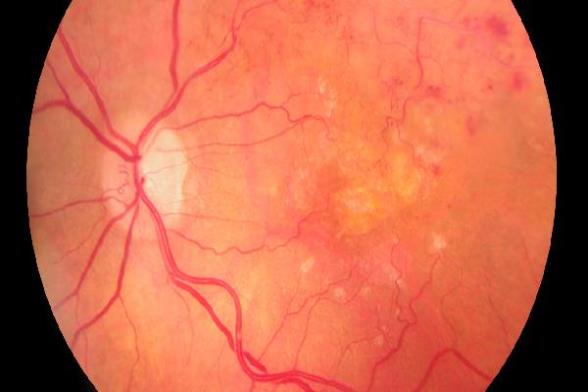 o4YBAGnEC5mAQCSqAABWidHis4Q583.jpg