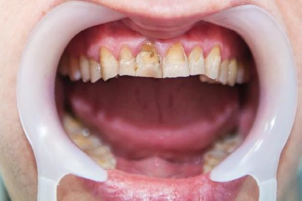 oYYBAGoLADGAb8lsAABT3J7KZTY965.jpg