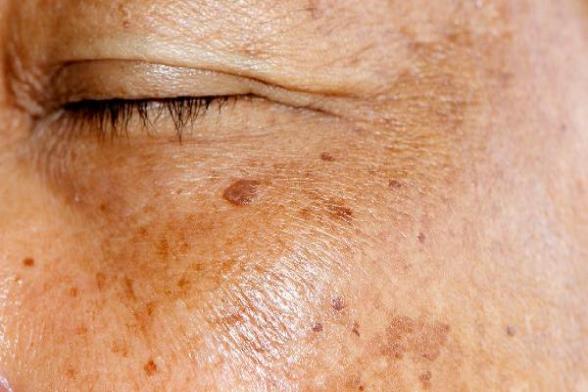 ooYBAGoK6HSAbKgdAACTfYy-5EI840.jpg