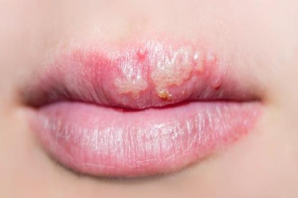 ooYBAGoLDCGAZWZ9AABH1oMx8DQ505.jpg